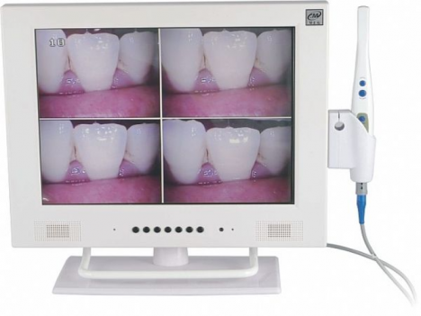 Mlg Camera MLG Intraoral Camera With Screen | DentaQ - Dental Products | DentaQ